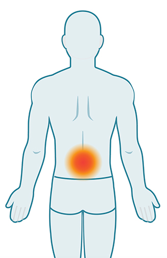 Musculoskeletal Disorders - OHCOW